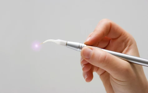 A hand holding a laser too used for laser dentistry services at Hornbrook Center for Dentistry in San Diego.